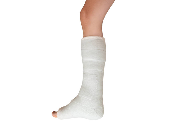 Woman with her broken leg. leg in a cast on isolated white background. Close up - Photo, Image