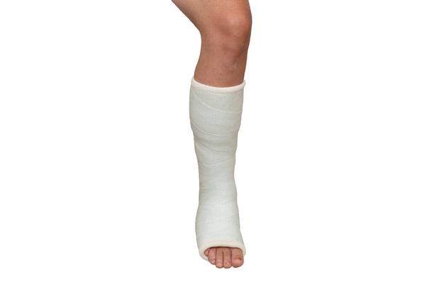 Vrouw met haar gebroken been. been in een gips op geïsoleerde witte achtergrond. Sluiten. - Foto, afbeelding