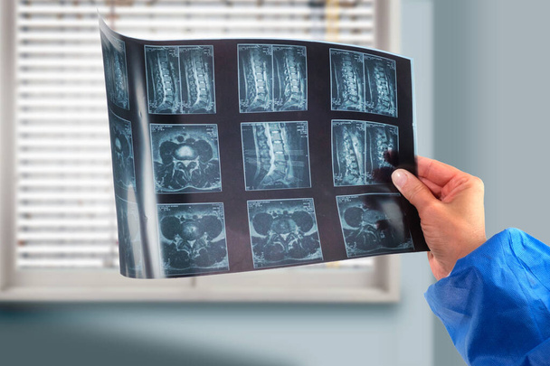 Un médecin tient et analyse la radiographie de la colonne vertébrale.  - Photo, image