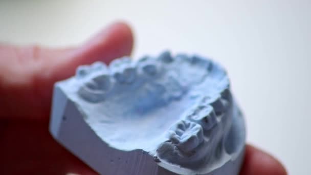 Orthodontist met tandafdruk en tandspalk met zijn handen voor tandheelkundige bescherming tegen bruxisme en gnash bescherming als tandheelkundige chirurgie voor beugels tegen onderbeet of kruisbeet door pleister - Video