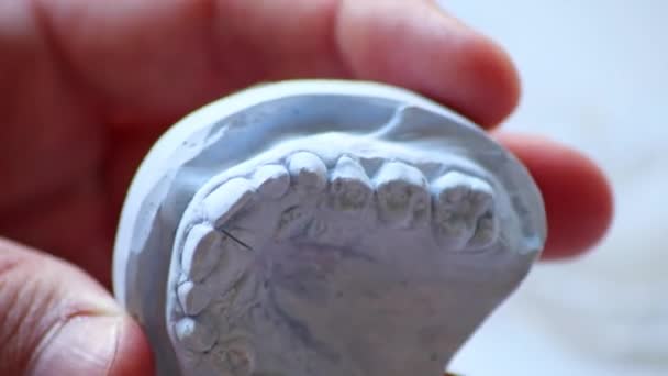 Kieferorthopäde mit Zahnabdruck und Zahnschiene als zahnärztlicher Schutz gegen Bruxismus und Knirschschutz bei Zahnspangen gegen Unterbiss oder Kreuzbiss durch Gips - Filmmaterial, Video