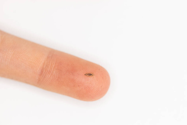Um piolho humano em um dedo quando os piolhos foram descobertos no cabelo de uma criança - Foto, Imagem