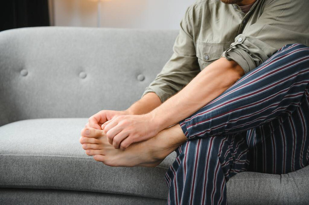 Man's legs have symptoms Itchy feet caused by fungi - Foto, afbeelding