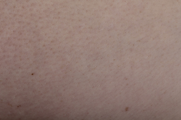 Textur der menschlichen Haut weiß - Foto, Bild