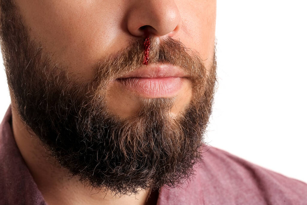 Young bearded man with nosebleed on white background, closeup - Фото, зображення