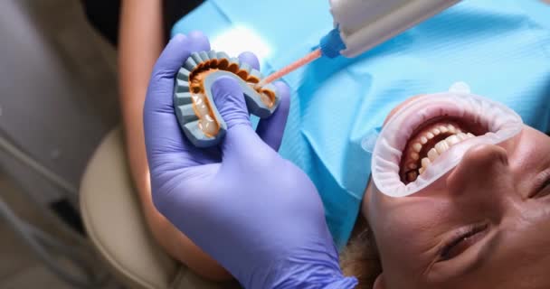 Otisk zubního materiálu a zubního technika vytváří zubní zásobník. Instalace zubních dýh - Záběry, video