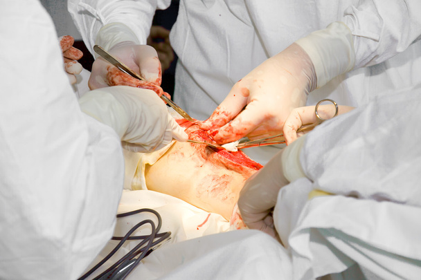 Лікарі з інструментами в руках роблять операцію
 - Фото, зображення