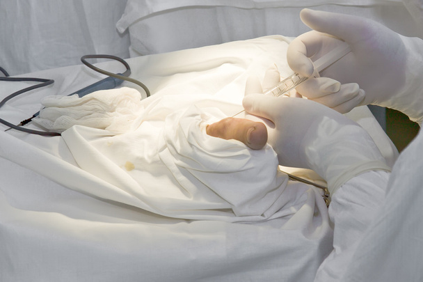 Médicos con herramientas en las manos haciendo cirugía
 - Foto, Imagen