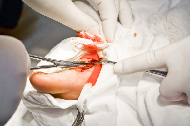 Ärzte mit Werkzeugen in der Hand machen Chirurgie - Foto, Bild