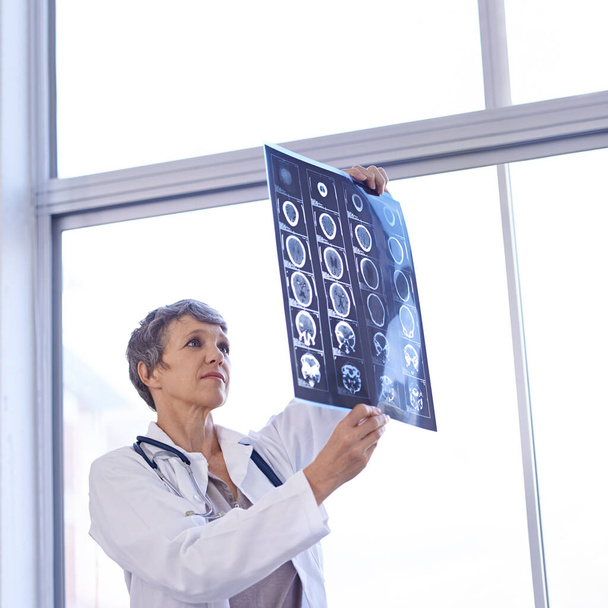 Un aperçu du cerveau humain. une femme médecin étudiant les rayons X - Photo, image