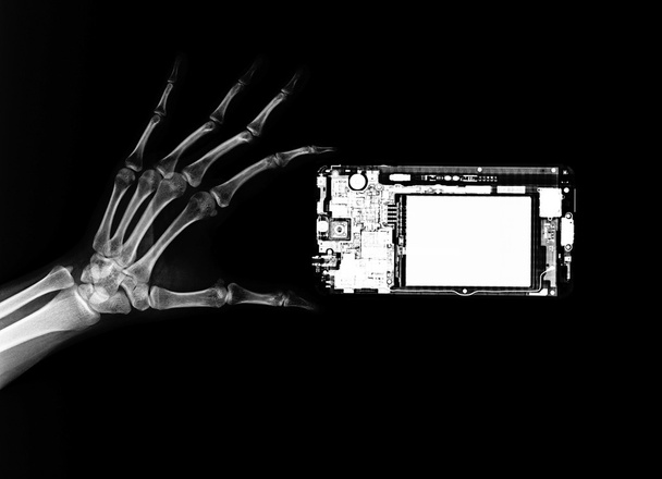 Σκελετό τα χέρια και το κινητό τηλέφωνο για ακτινογραφία - Φωτογραφία, εικόνα