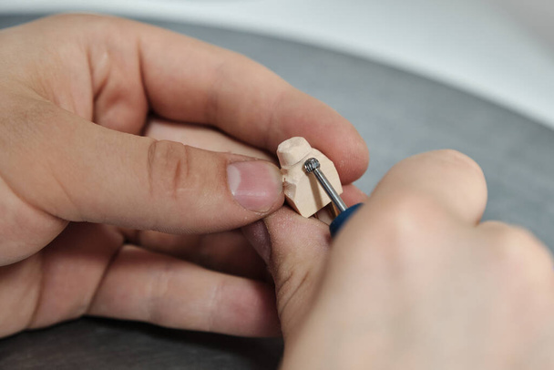 Close up photo of dental technician working on a tooth crown. Tooth neck engraving on a gypsum model - Zdjęcie, obraz