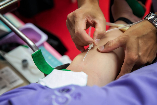 Krankenschwester sticht medizinische Nadeln in Spenderarm. Blutspender spenden im Krankenhaus. - Foto, Bild