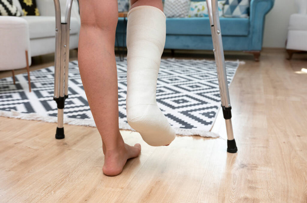 Frau läuft mit gebrochenem Bein auf Teppich, Frontansicht - Foto, Bild