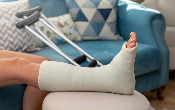 broken ankle and a leg cast. Leg splint - Foto, afbeelding