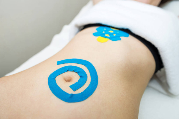 kinesio tape on the abdomen of a young woman - Fotografie, Obrázek