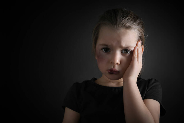 Little girl with bruises on face against dark background, space for text. Domestic violence victim - Foto, afbeelding