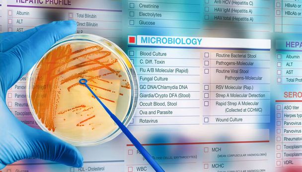 Doctor with petri plate culture and microbiological digital test petition form. microbiologist holding petri dish with Streptococcus agalactiae bacterial colonies on a digital microbiology test request form - Photo, Image