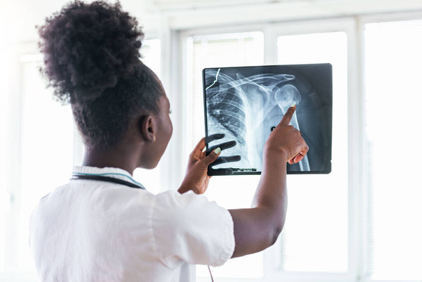 X-ray film image with doctor for medical and radiological diagnosis on female patient's health on disease and bone cancer illness, healthcare hospital service concept - Photo, Image