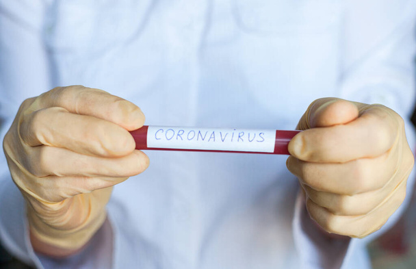 Ręce w rękawicach medycznych z rurką do badań krwi z wynikami w kierunku zakażenia Coronavirus (Covid-19). Epidemia choroby koronawirusowej. - Zdjęcie, obraz