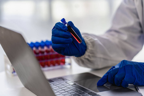 Επιστήμονας χέρι κρατώντας ένα δοκιμαστικό σωλήνα με αίμα στο εργαστήριο ιατρική έννοια - Φωτογραφία, εικόνα