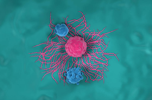 甲状腺がん細胞 – 上図3Dイラスト - 写真・画像