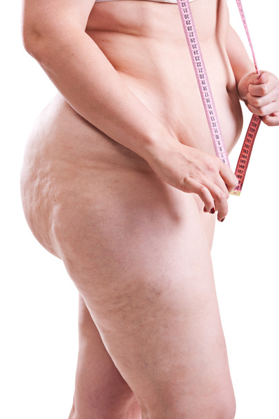 Torso of a woman with obesity - Фото, изображение