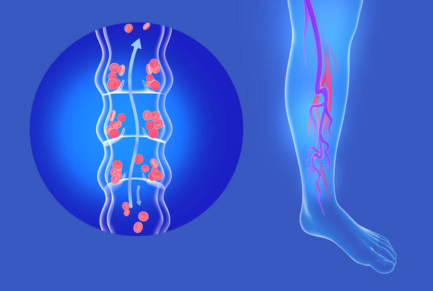 Ilustração 3d anatômica de veias incompetentes e varizes nas pernas. Sistema circulatório transparente das veias. - Foto, Imagem