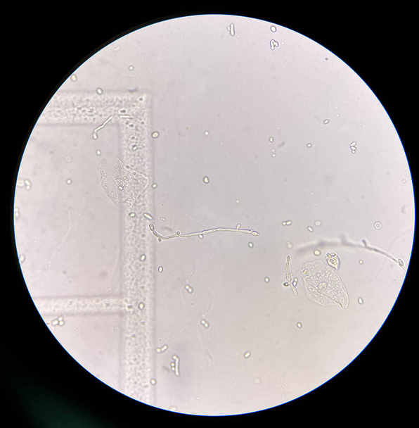 Budding hiiva soluja pseudohyfae virtsanäytteen löytää mikroskoopilla 40X - Valokuva, kuva