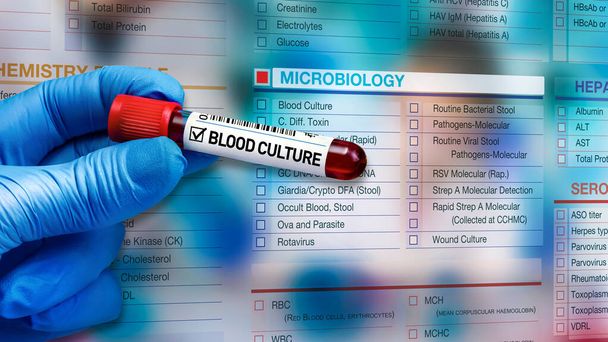 Μικροβιολόγος με σωλήνα αίματος για την καλλιέργεια σε πλάκα και μικροβιολογικές ψηφιακές δοκιμές έντυπο αναφοράς για μικροβιολογικό εργαστήριο. Γιατρός κρατώντας σωλήνα δείγματος αίματος για ανάλυση και υπόβαθρο μικροβιολογίας αίτηση δοκιμής μορφή - Φωτογραφία, εικόνα