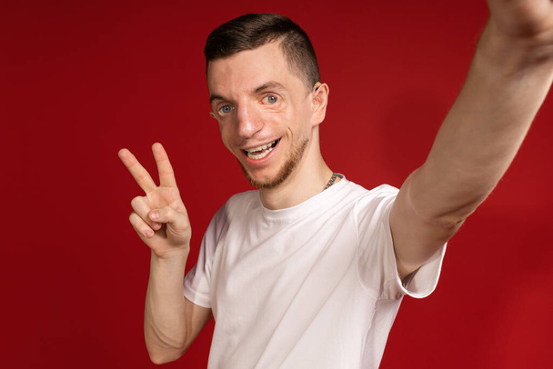 Junger Mann im weißen T-Shirt mit Treacher-Syndrom macht Selfies, Menschen mit Behinderungen, genetische Erkrankungen - Foto, Bild