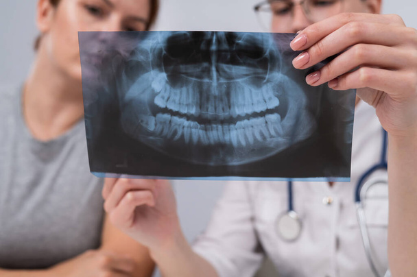A woman doctor and a patient at the reception are discussing an x-ray of the jaw - Foto, afbeelding