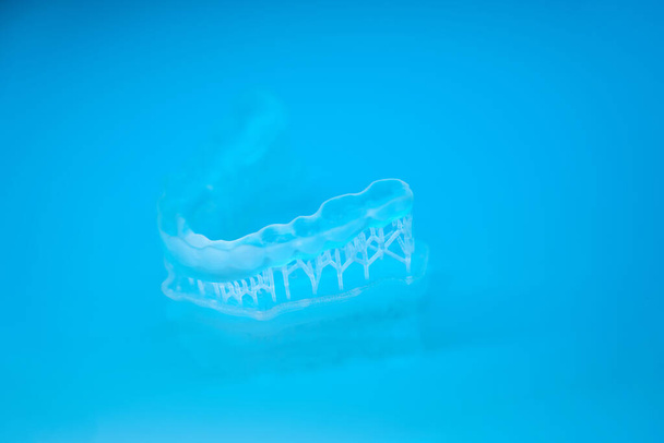 Impression of a clear aligner to correct an overbite - Foto, Imagem