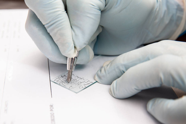 Laboratorian σήμανση ένα μικροσκόπιο διαφάνεια χρησιμοποιώντας ένα μολύβι άκρη διαμάντι. Laboratorian που επιτρέπει την εισαγωγή σε δείγματα επίχρισης Παπανικολάου στο εργαστήριο για ανάλυση. - Φωτογραφία, εικόνα