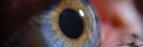 Iris 'te parlak mavi gözlü bir kadın. Lazer görüş düzeltme kavramı - Fotoğraf, Görsel