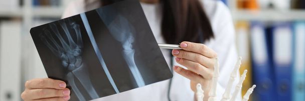 El traumatólogo médico examina la radiografía con lesión en el brazo. Diagnóstico y tratamiento del dolor en las manos concepto - Foto, imagen
