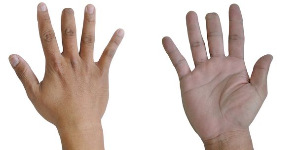 Азіатських людині правою рукою з поранених середній палець - Фото, зображення