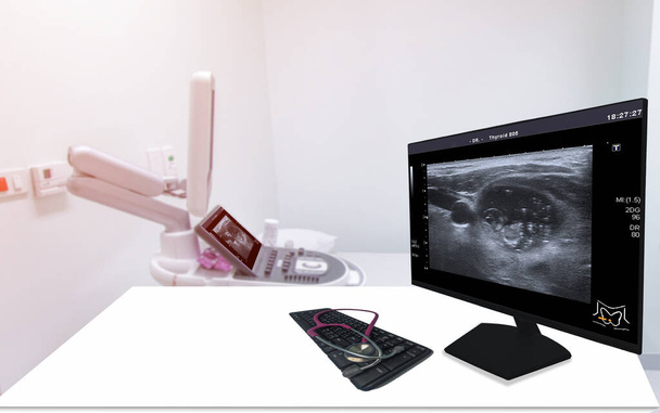 Ultrazvuk pacientovy štítné žlázy byl hlášen na monitoru v nemocnici pro léčbu tyreotoxikózy a hypotyreózy, koncepce lékařského obrazu. - Fotografie, Obrázek
