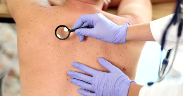 Ο γιατρός κοιτάζει μέσα από μεγεθυντικό φακό στην πλάτη του ασθενούς. Εξέταση δέρματος και κρεατοελιές - Πλάνα, βίντεο