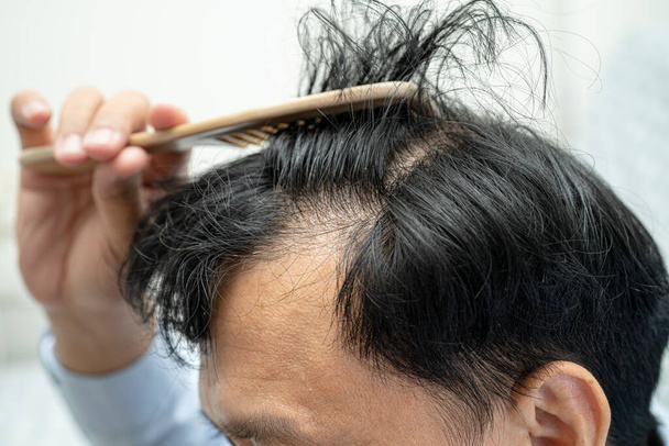 Φαλακρός στο μεσαίο κεφάλι και να αρχίσει καμία απώλεια μαλλιά glabrous ώριμη ασιατική επιχείρηση έξυπνο ενεργό γραφείο άνθρωπος. - Φωτογραφία, εικόνα
