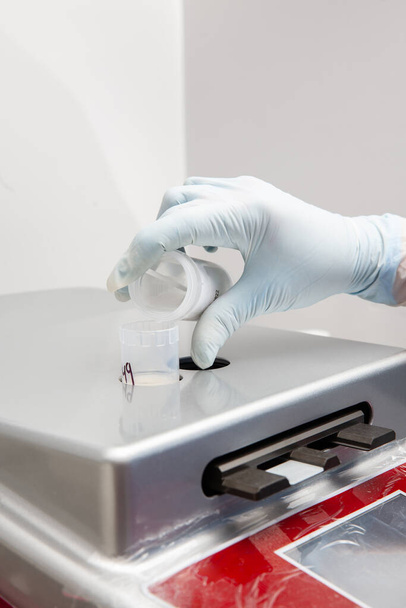 研究者は、紙のスミアテストのための液体ベースの細胞診法で顕微鏡スライドを準備します。子宮頸がんの概念。医学的概念. - 写真・画像
