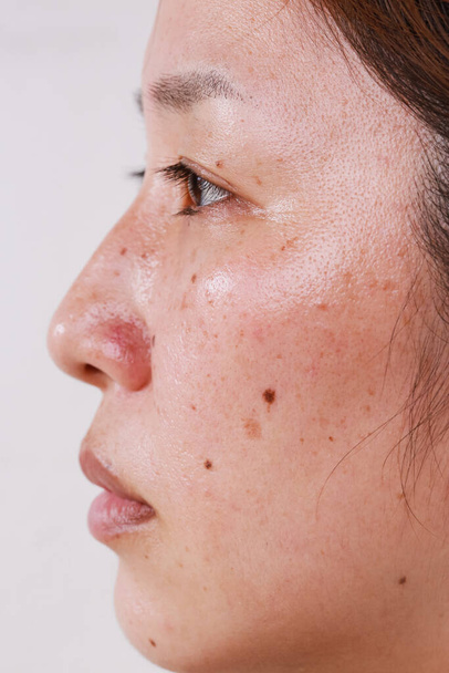 Primer plano de la cara de una mujer, media cara, retrato con poros grandes puntos negros cuidado de la piel problema y fondo blanco - Foto, Imagen