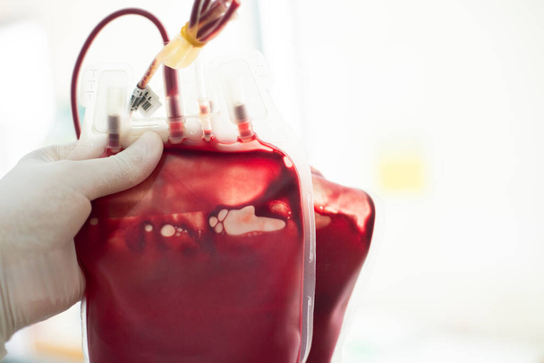 Bolsa de sangre en la mano scientis laboratorio banco de sangre. - Foto, imagen