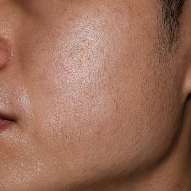 Tłusta twarz z szerokimi porami południowo-wschodniej Azji, Myanmar lub koreański dorosły mężczyzna. - Zdjęcie, obraz