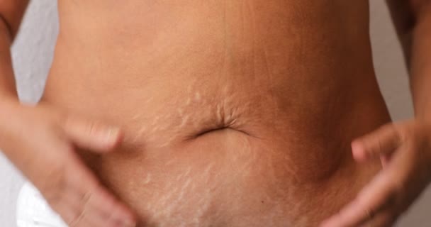 Close up of woman's belly with stretch mark loose lower abdomen skin she fat after pregnancy baby birth, studio isolated, unhealthy belly overweight excess body concept - Materiaali, video