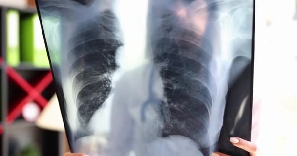 Il dottore guarda le radiografie dei polmoni con la polmonite in ospedale. Medico specialista e diagnosi di infezione coronovirus - Filmati, video