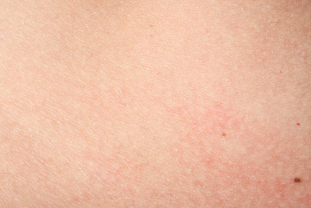 achtergrond van een roze huid textuur. Gezonde huid. Macro foto van huidcellen. - Foto, afbeelding