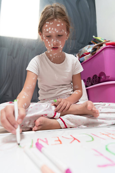 Little school girl with chickenpox drawing on white board in kids room, antiseptic cream applied to face and body. Chalkboard and toys background. High quality photo - Foto, Imagem