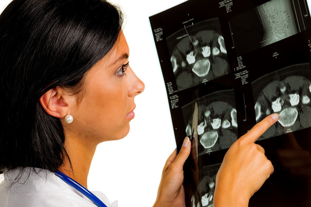 woman doctor with x-ray image - Φωτογραφία, εικόνα