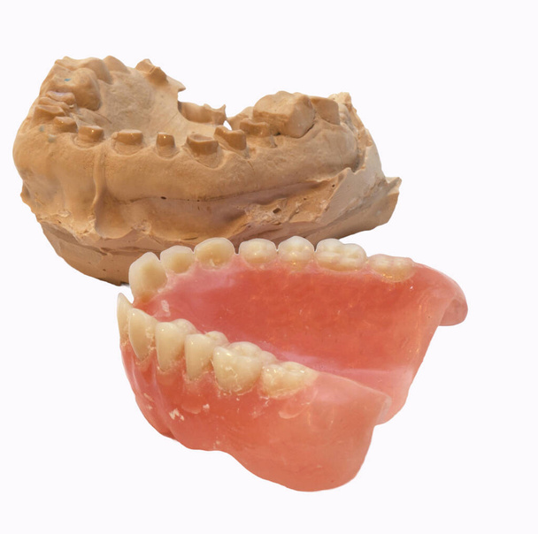 pleisterafdruk van het tandheelkundig apparaat - Foto, afbeelding
